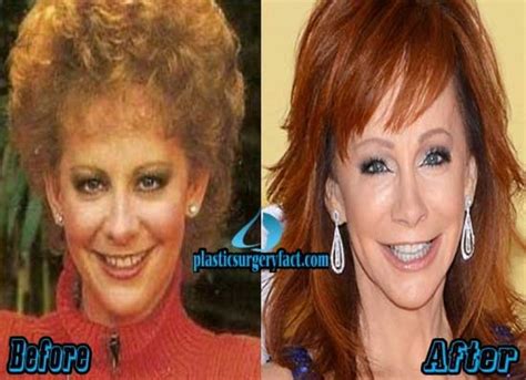 Reba Plastic Surgery Before After reba mcentire plastic surgery before ...