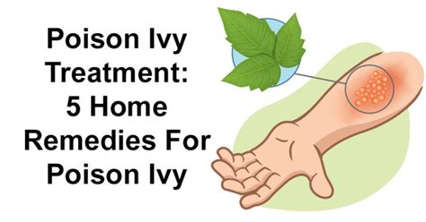 Poison Ivy Treatment: 5 Home Remedies For Poison Ivy - David Avocado Wolfe