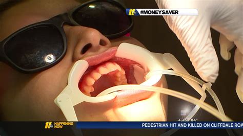 Nonprofit provides free braces for patients in need - ABC11 Raleigh-Durham