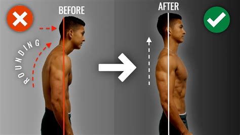 How To Fix Rounded Shoulders FAST (10 Minute Science-Based Corrective Routine) - YouTube