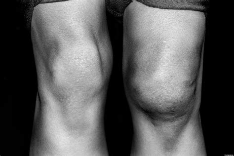 Knee Scan Identification: MRIs May Be Better Way To ID Travelers, Study Suggests | HuffPost