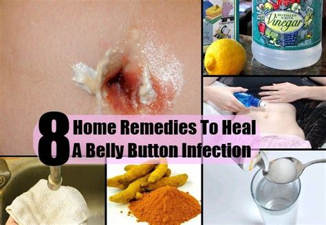 8 Top Home Remedies To Heal A Belly Button Infection | Infected belly ...