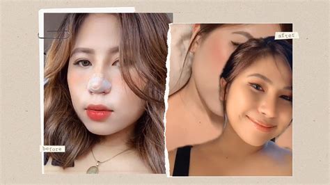 WATCH: People Document Their Nose Jobs on Tiktok | Preview.ph