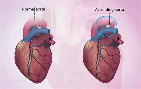 Health Condition : Symptoms, Causes, Treatment and More