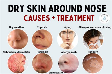 Dry and Peeling Skin Around Nose: 13 Causes & How to Treat it