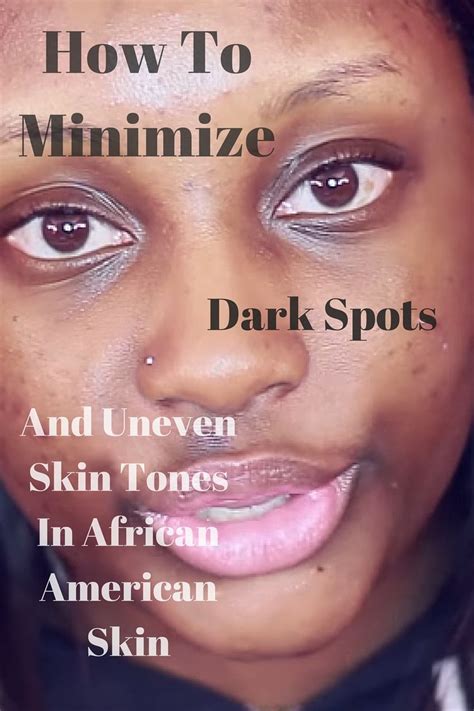How to Minimize the Appearance of Dark Spots and Uneven Skin Tone In A - Nyraju Skin Care | Dark ...