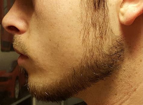 19y/o trying to grow a chinstrap - Beard Board