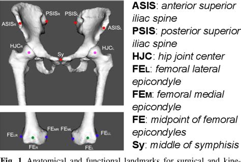 [PDF] ASIS : anterior superior iliac spine PSIS : posterior superior ...