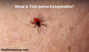 Tick-borne encephalitis - Symptoms, Diagnosis, Treatment, Prevention