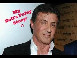 sylvester stallone bell palsy ile ilgili görsel sonucu | Şimşek