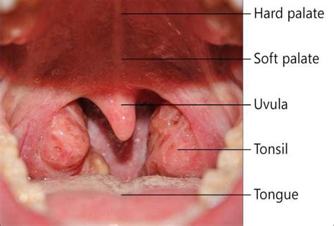 Throat Cancer Symptoms | MedGuidance