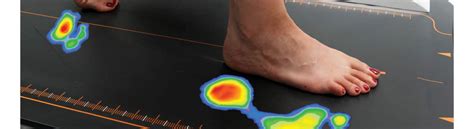 Pressure plate Gait analysis | Kent Sport Podiatry | United Kingdom