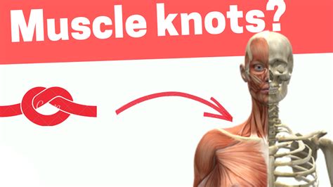 What are muscle knots? how to get rid of muscle knots : Physiosunit