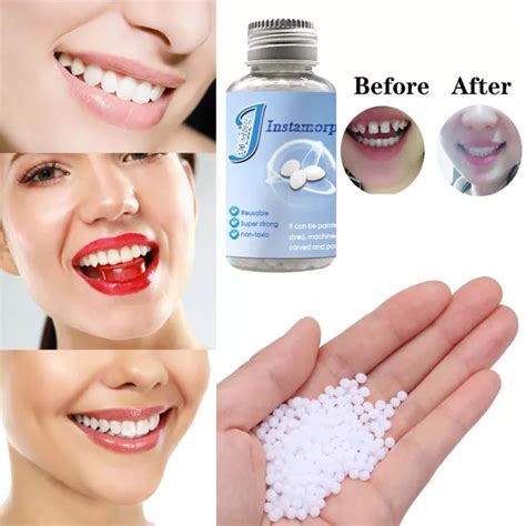 Denture Adhesive Glue Repair Denture False Teeth Solid Glue Replace Missing Denture Tooth ...