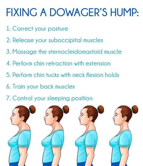 Dowager's Hump Fix: Avoid a Dowager's Hump - Granny Health Today | Neck ...