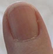 Vitamin B12 and Fingernails | Health Boundaries | Fingernail health, Nail health signs, Nail health