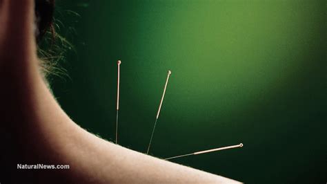 Latest study reinforces link between acupuncture and relief from hot ...