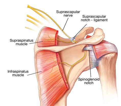 The Suprascapular Nerve Block - Sports Medicine Review