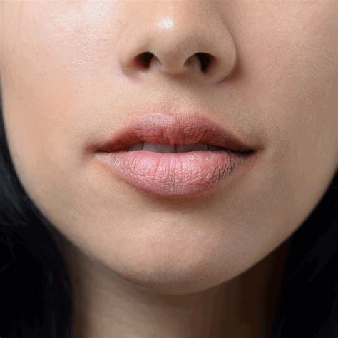 What Causes Red Rash On Lips | Lipstutorial.org