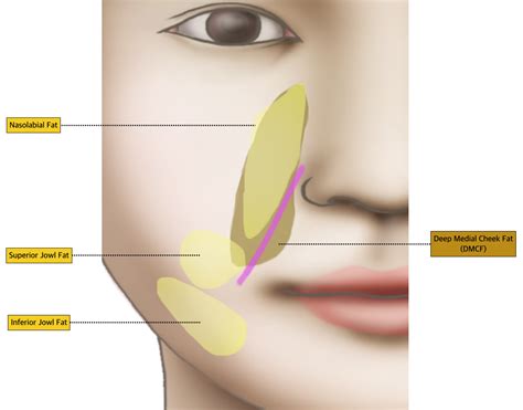 #4-1. Mid Face: Nasolabial fold | D&PS | Nasolabial folds, Face fillers ...