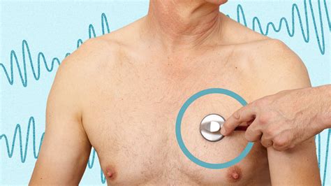 Chest Auscultation: Explanation & Procedure | Ausmed