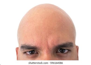 Half Bald Head Photos and Images | Shutterstock