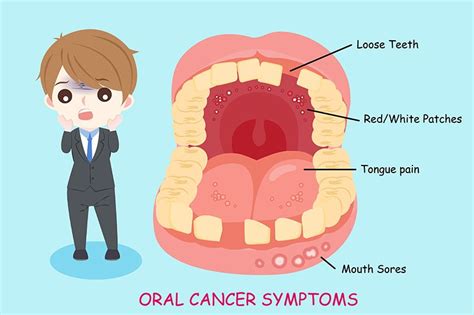 Oral Cancer Treatment Bangalore | Mouth Tumor Surgery