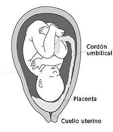 The Well-Rounded Mama: Placenta Previa and Prior Cesarean