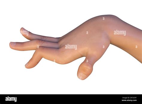 A hand of a child with chorea, a hyperkinetic movement disorder. Computer illustration showing ...