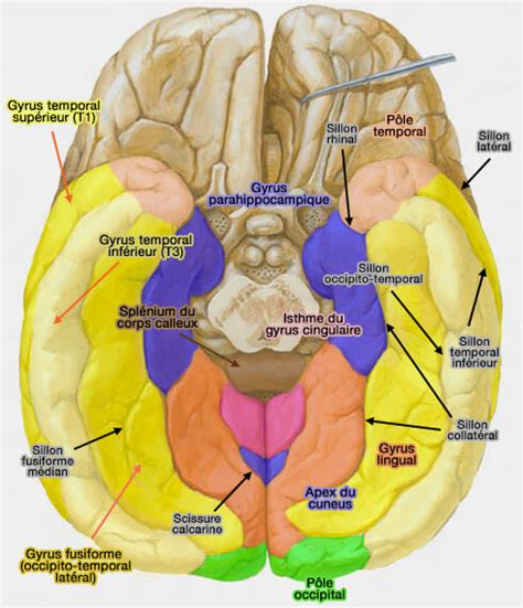 Téléncépahale : Lobe temporal (gyrus fusiforme ou occipito-temporal)