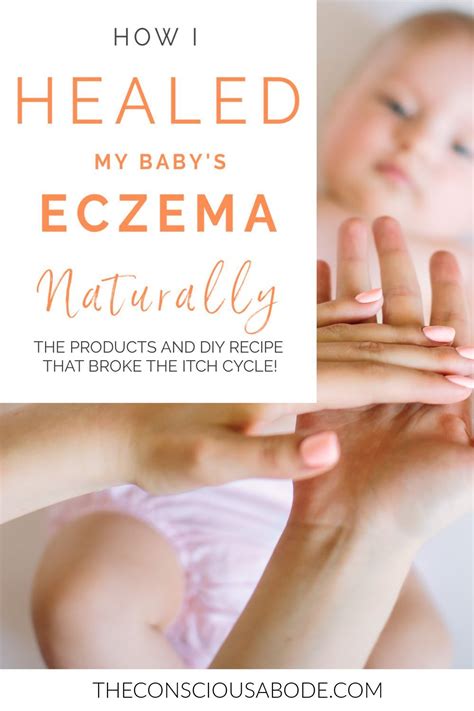 Natural Eczema Solution (That Actually Works) | Baby eczema remedies ...