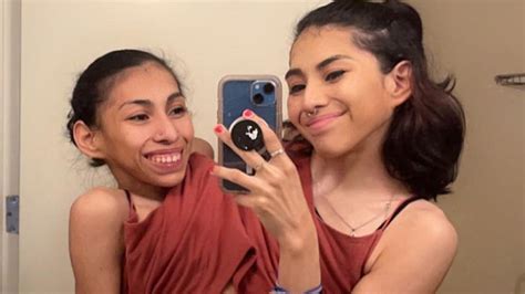 Conjoined TikTok stars reveal they don’t share a boyfriend - Dexerto