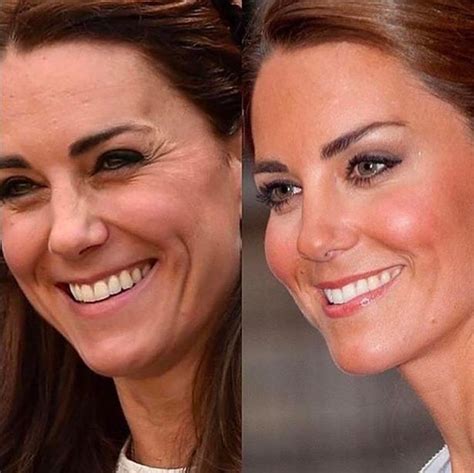 Plastic surgery clinic used Kate Middleton's image to advertise ...