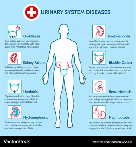 Urinary system diseases Royalty Free Vector Image