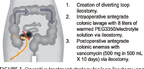 Figure 1 from Diverting loop ileostomy and colonic lavage: an alternative to total abdominal ...