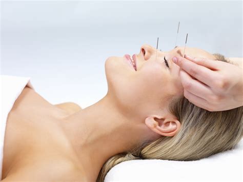 Fine Opportunities With The Best Acupuncture Techniques - Herbal Suite Blog