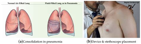 Sensors | Free Full-Text | Tabla: A Proof-of-Concept Auscultatory ...