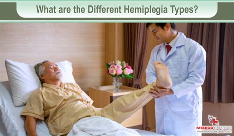 What are different hemiplegia types and its treatment?