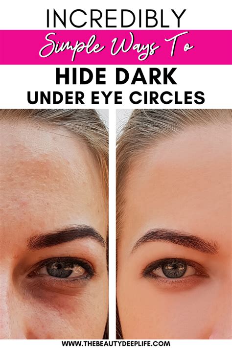 Cover Up Dark Circles Under Eyes, Covering Dark Undereye Circles, Dark ...