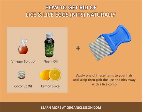 Quick Way To Get Rid Of Nits - Just For Guide