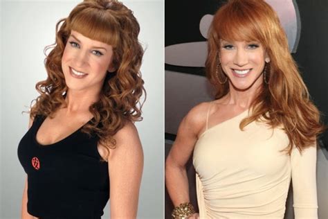 Kathy Griffin Plastic Surgery Nose Job Before and After Pictures