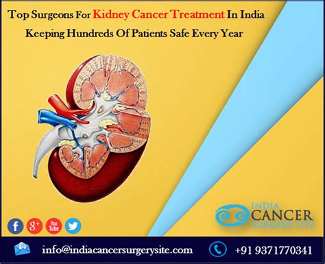 India Cancer Surgery Consultant: Top Surgeons For Kidney Cancer Treatment In India Keeping ...