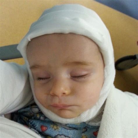 After surgery After Surgery, Grayson, Face, The Face, Faces, Facial