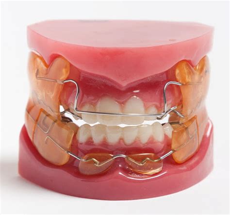 Frankel Function Regulator - British Orthodontic Society (BOS)