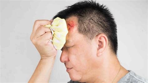 Head injury causes, types, when to worry, assessment & head injury ...