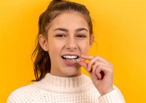 Things You Need To Know About Teeth Straightening at Home