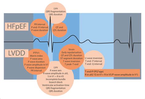 | ECG features studied for HFpEF and LVDD, grouped by phase in the... | Download Scientific Diagram