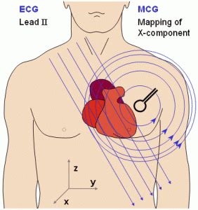 Heart-Brain Connection - Quantum LifeSource