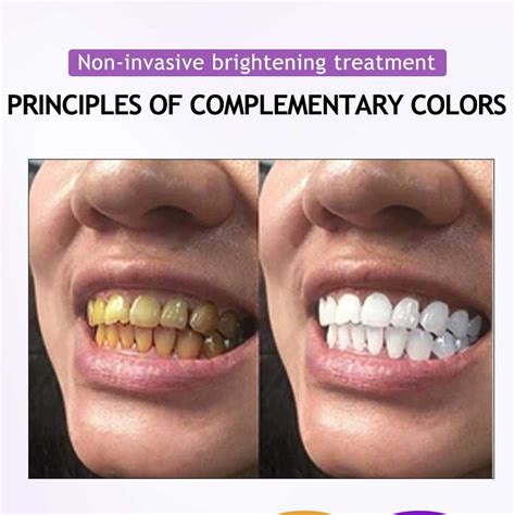 Purple Teeth Tooth Stain Removal Teeth Booster ning Toothpaste Pearlie Active Remineralization ...