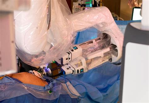 Single-port robotics reduce incisions, may lead to less pain and quicker recovery from ...